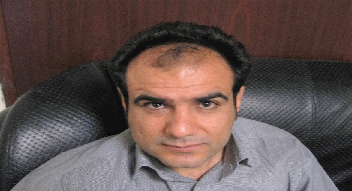 کاشت مو