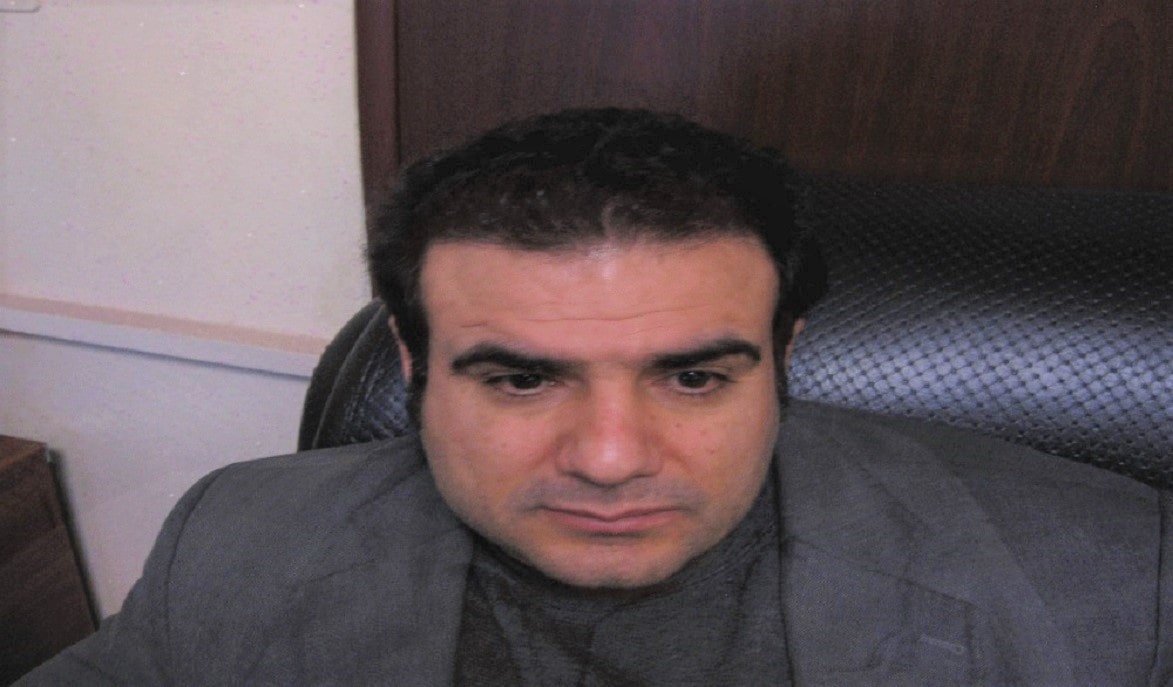 کاشت مو