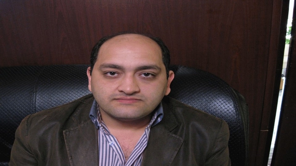 نمونه کاشت مو