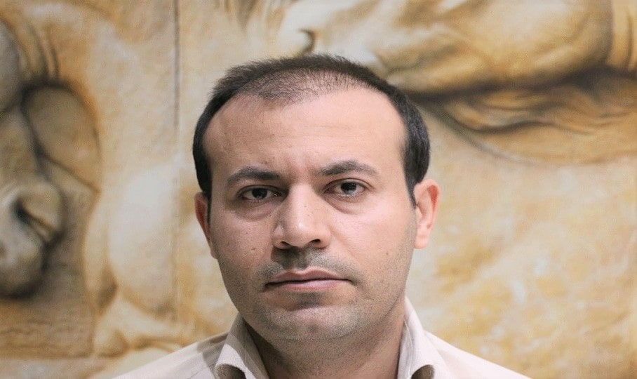 نمونه کاشت مو
